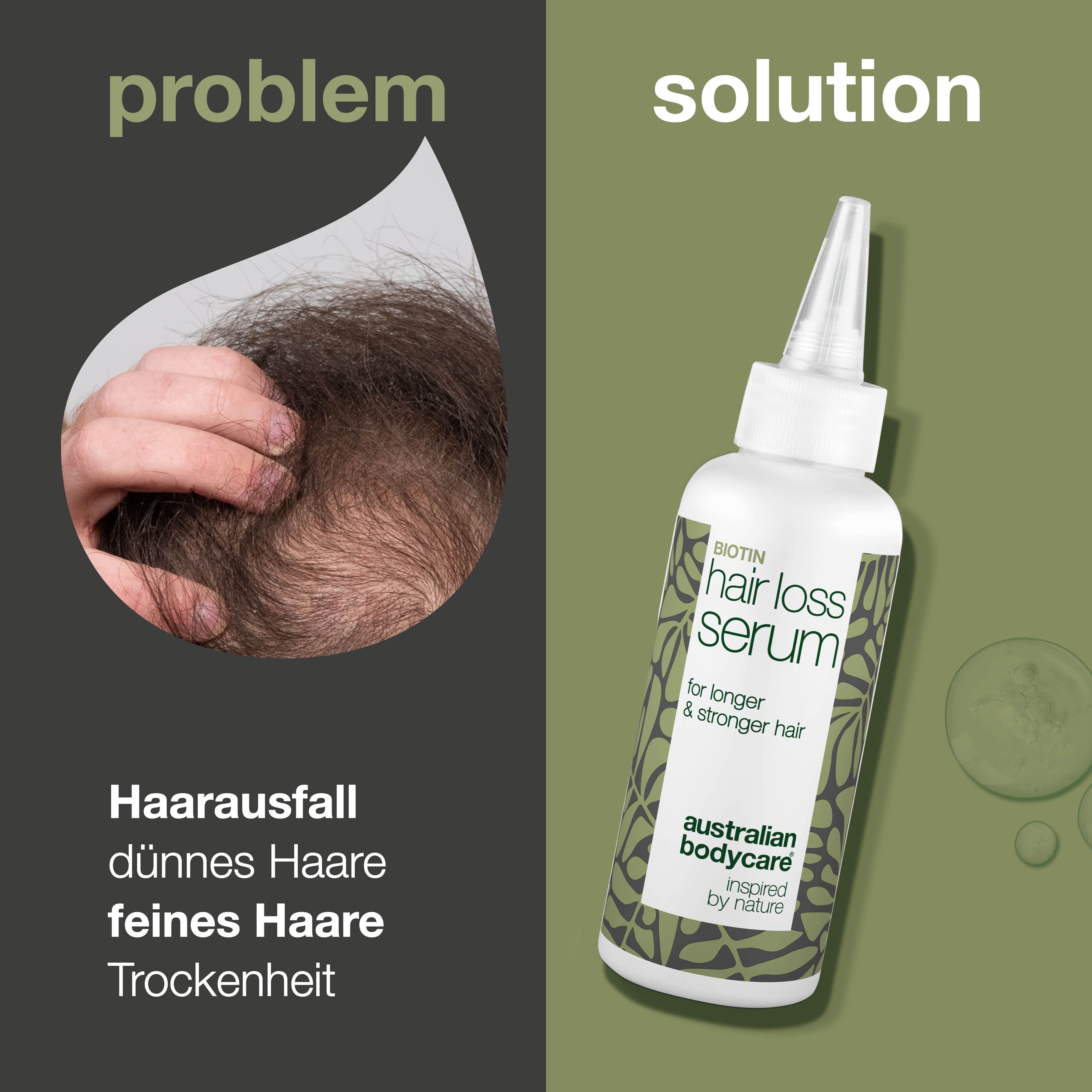 Haarausfall und Serum. Serum-Flasche mit Aufschrift "Hair Loss Serum". Marke: Australian Bodycare.