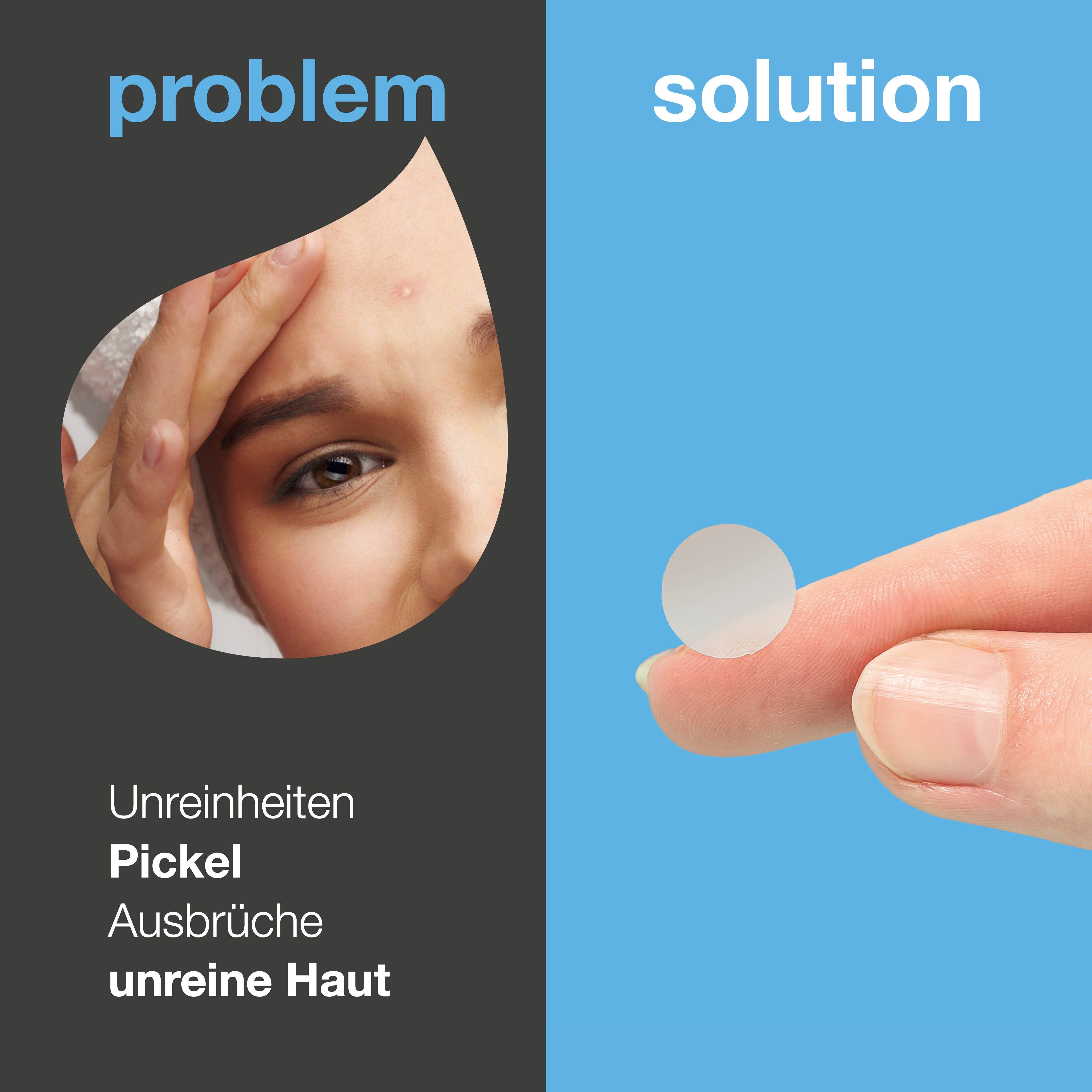 Aufgeteiltes Bild: Problem und Lösung. Links: Gesicht mit Pickel. Rechts: Ein Pflaster auf einem Finger.