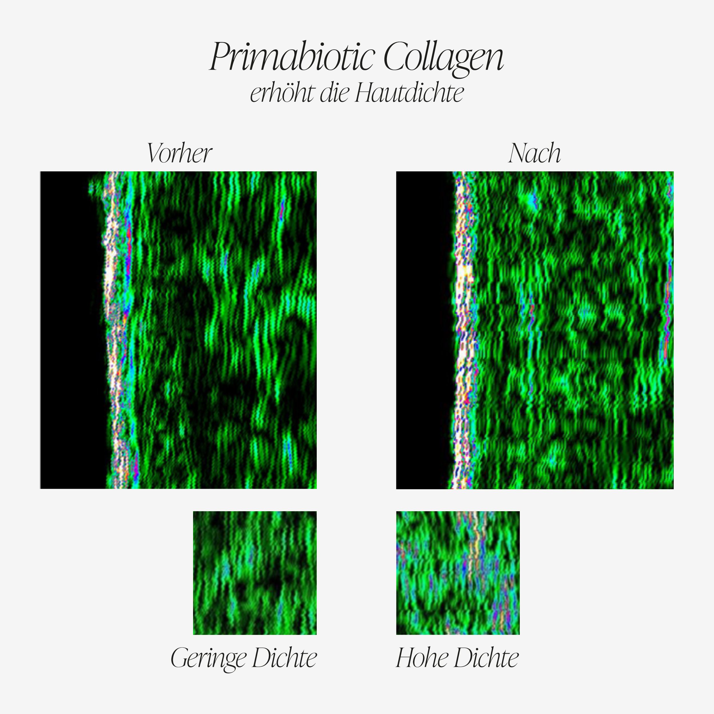 Vergleich von Hautbildern vor und nach der Anwendung. Text: Primabiotic Collagen erhöht die Hautdichte. Vorher: geringe Dichte. Nachher: hohe Dichte.
