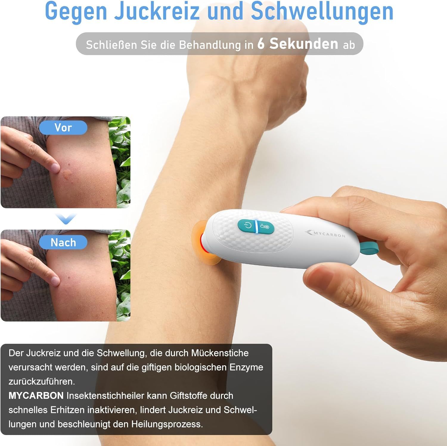 Person zeigt Arm mit Insektenstich. Gerät wird auf Stich angewendet. Text: Gegen Juckreiz und Schwellungen. MYCARBON-Logo.