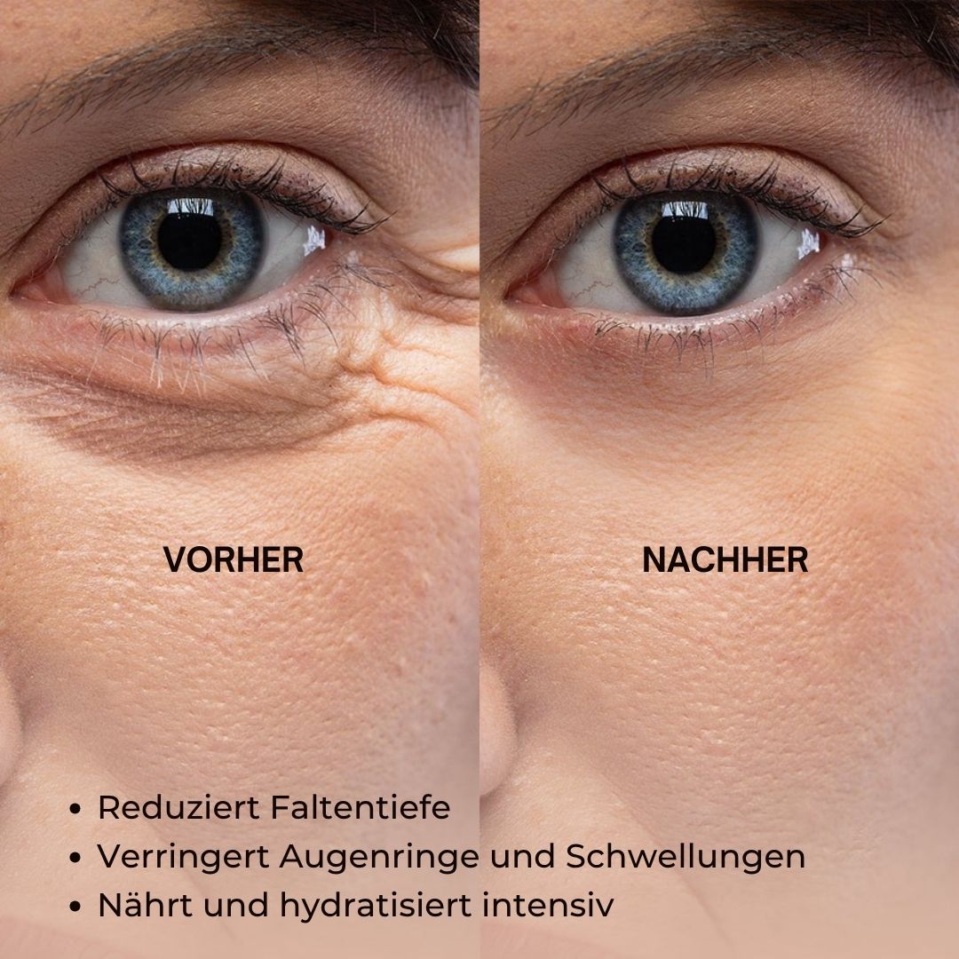 Vorher-Nachher-Bild. Augenpartie mit Falten und Augenringen. Nachher: weniger Falten, weniger Augenringe, intensive Feuchtigkeit.