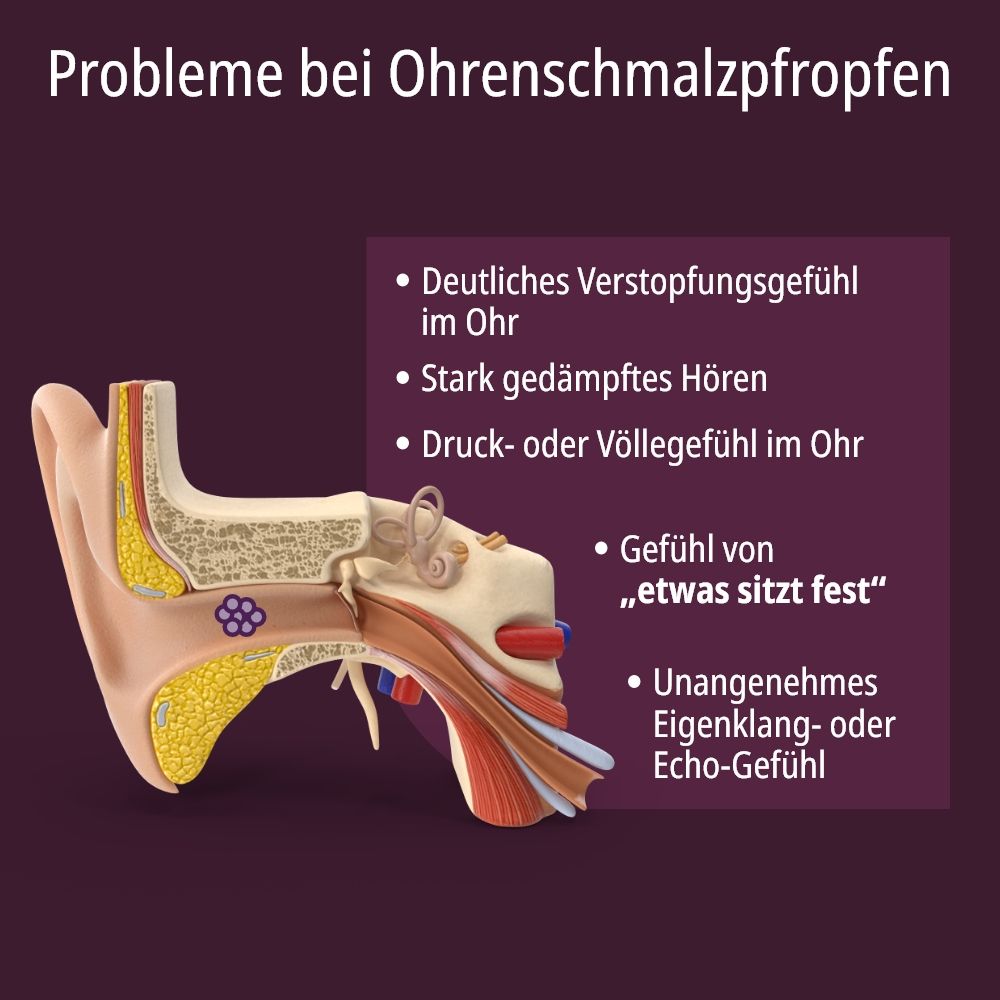 Anatomische Darstellung des Ohrs. Darstellung von Ohrenschmalzpfropfen. Text: Probleme bei Ohrenschmalzpfropfen.