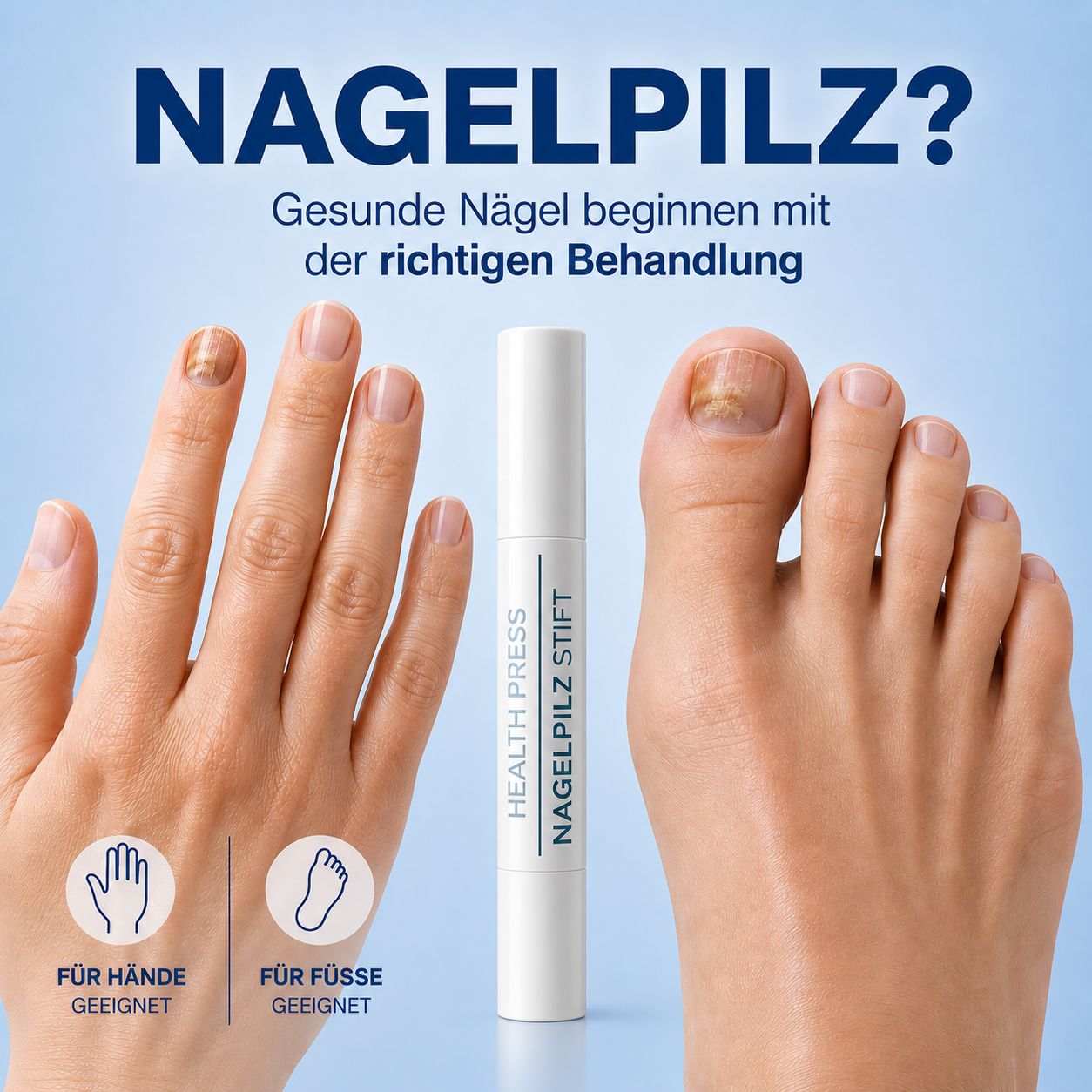 Hand- und Fußnägel mit Nagelpilz. Text: Gesunde Nägel beginnen mit der richtigen Behandlung. Für Hände und Füße.
