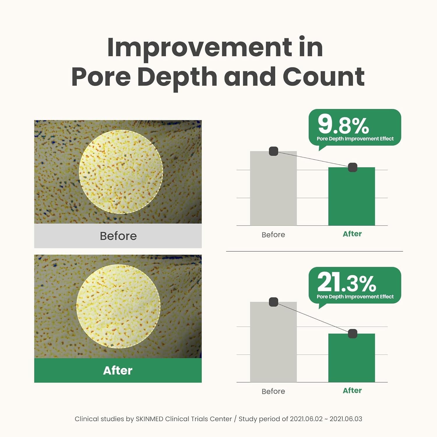 AXIS-Y Mugwort Pore Clarifying Wash Off Pack Exfoliating Face mask