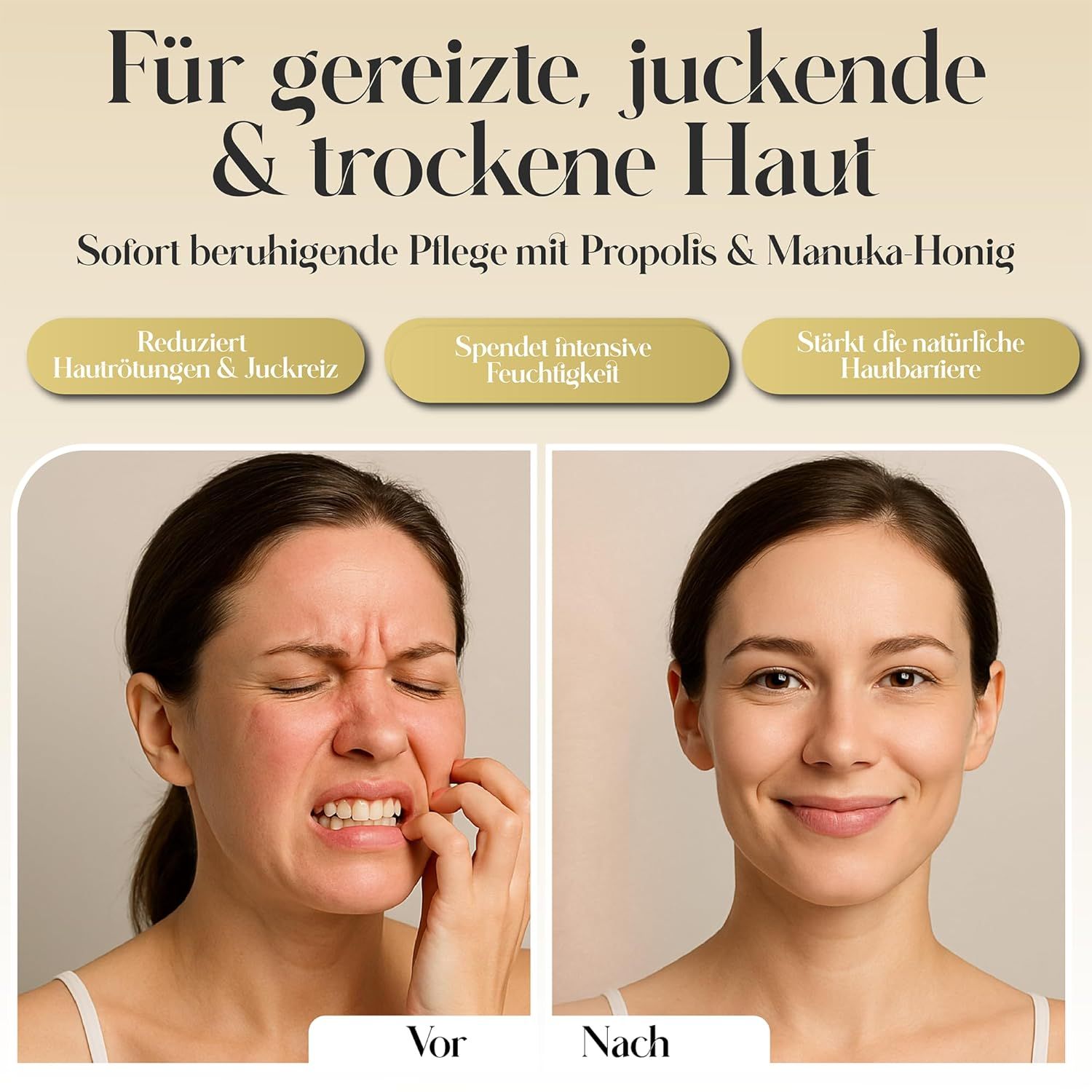 Vorher-Nachher-Bild. Frau kratzt sich, dann lächelt sie. Text: 'Für gereizte, juckende & trockene Haut'. Text: 'Reduziert Hautrötungen & Juckreiz'.