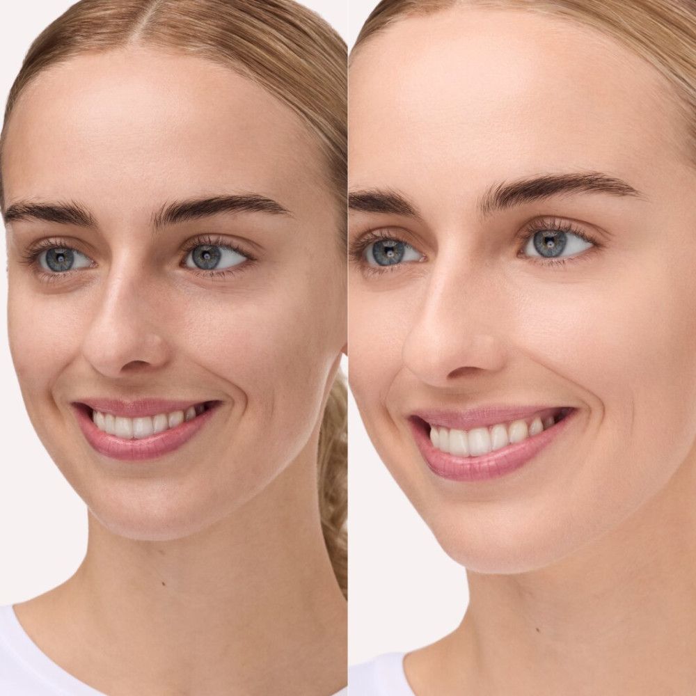 Vergleich: Gesicht vor und nach Anwendung. Haut wirkt ebenmäßiger und strahlender. Frau mit hellem Teint.