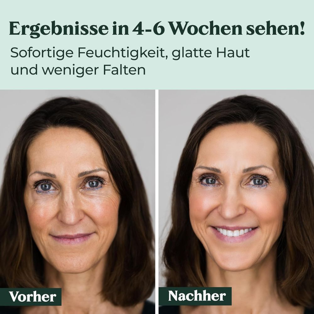Vorher-Nachher-Vergleich. Frau mit Falten, dann glattere Haut. Text: Ergebnisse in 4-6 Wochen sehen! Sofortige Feuchtigkeit, glatte Haut, weniger Falten.