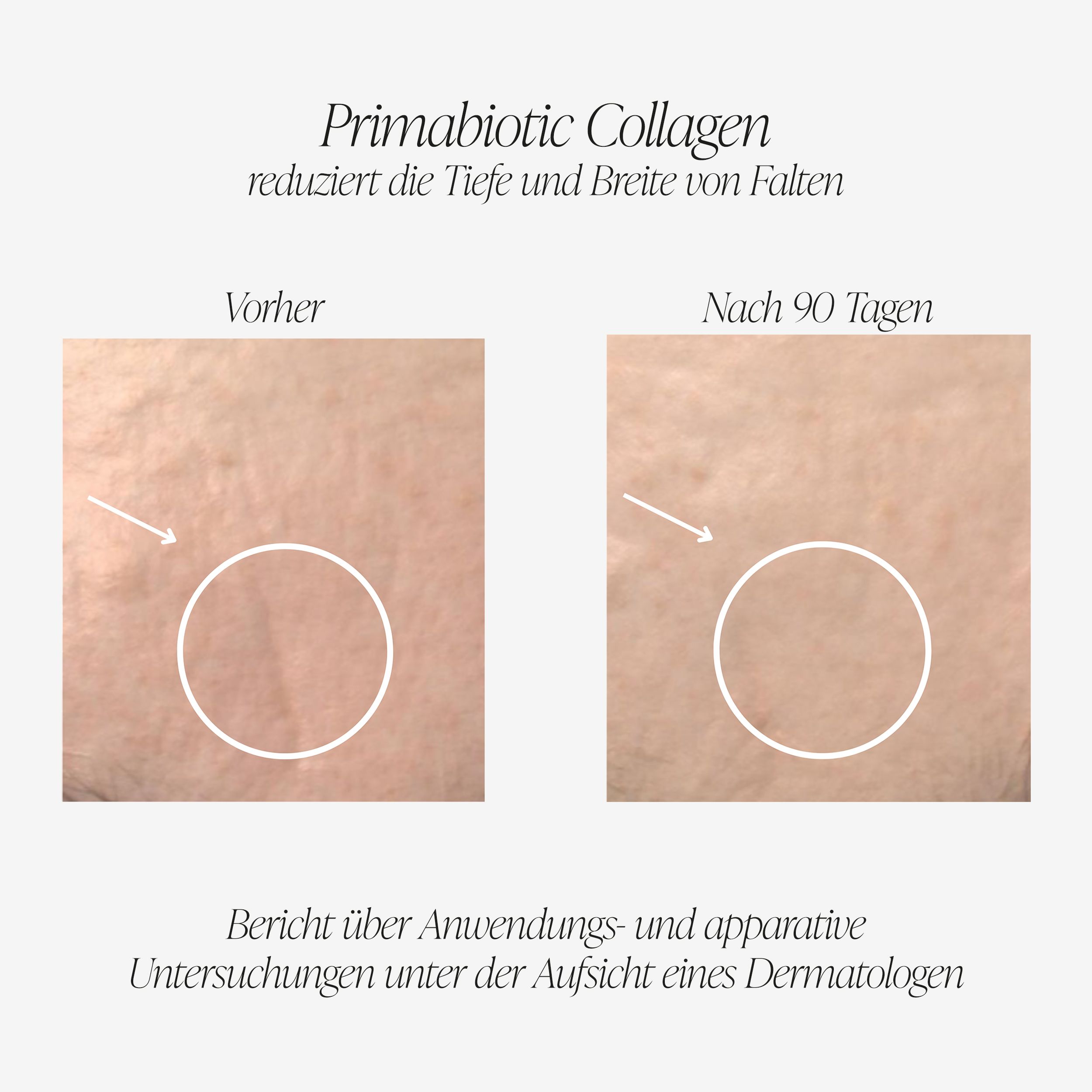 Vergleich von Hautbildern vor und nach 90 Tagen. Text: Primabiotic Collagen reduziert die Tiefe und Breite von Falten. Vorher/Nachher.