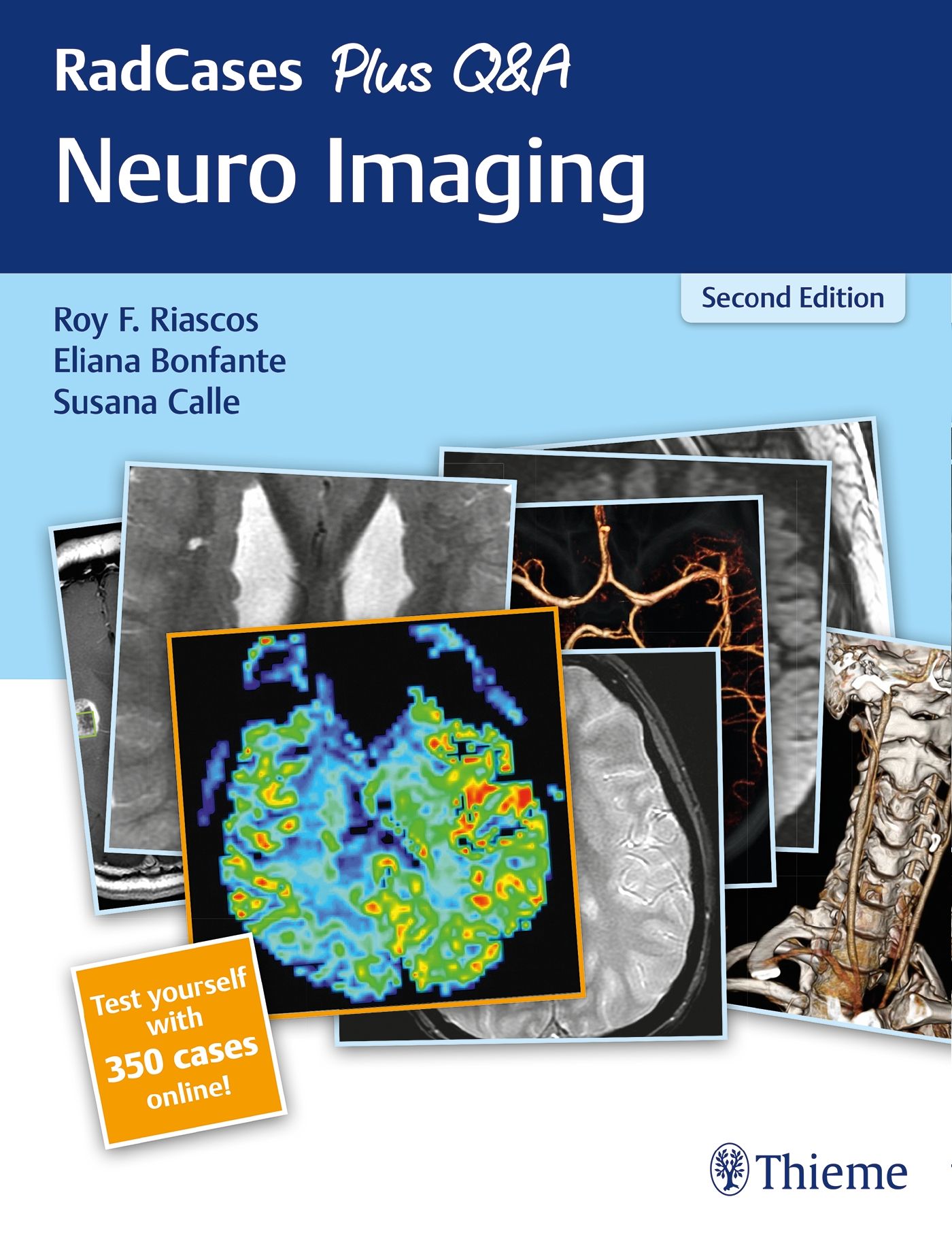 Buchcover mit Titel 'RadCases Plus Q&A Neuro Imaging'. Autoren: Riascos, Bonfante, Calle. 'Second Edition'. Thieme-Logo. Mit MRT-Bildern.