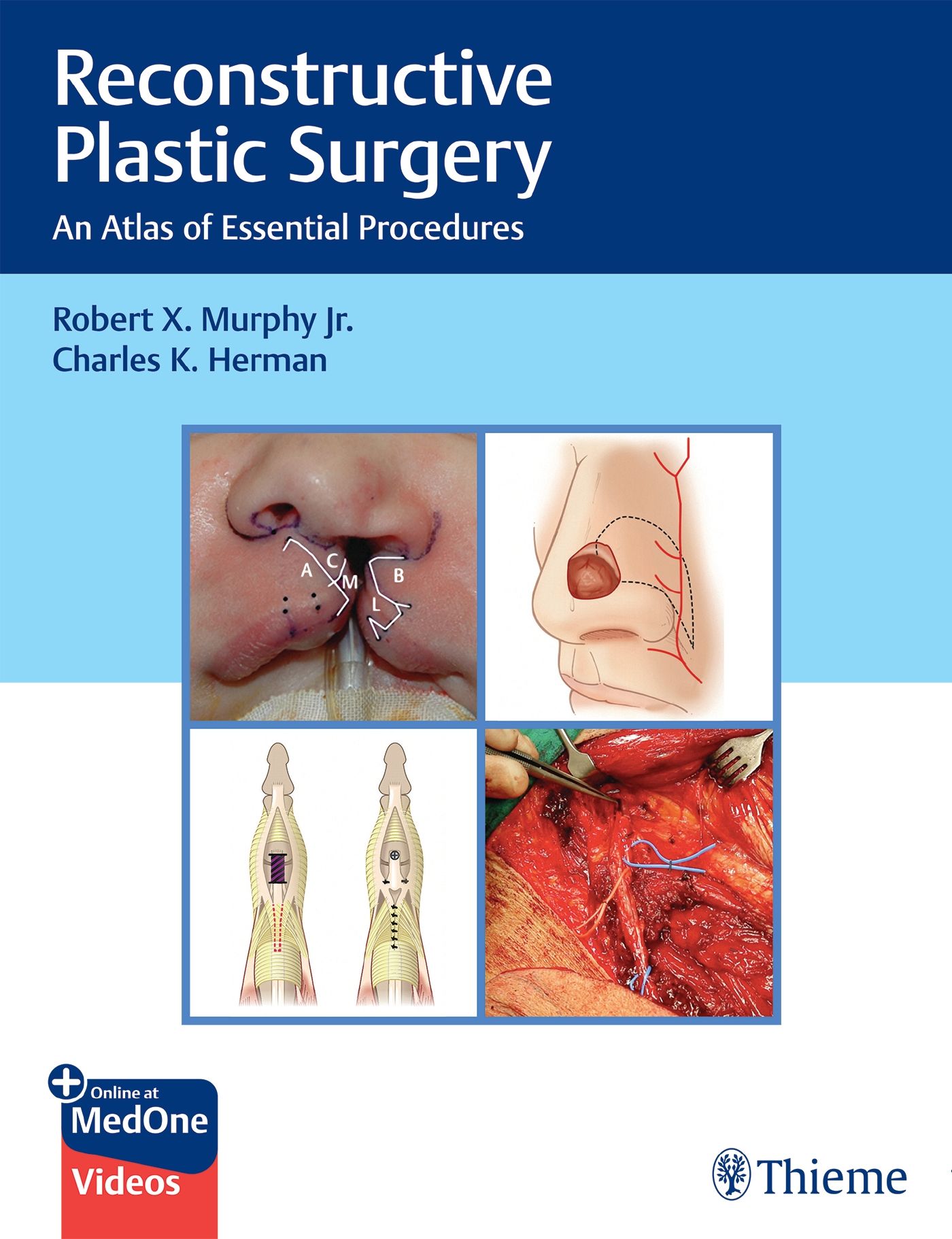 Buchcover mit Titel "Reconstructive Plastic Surgery". Untertitel: "An Atlas of Essential Procedures". Autoren: Robert X. Murphy Jr., Charles K. Herman. Verlag Thieme.